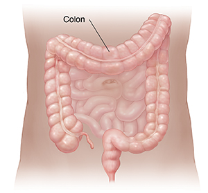 Ulcerative colitis: Video, Anatomy & Definition