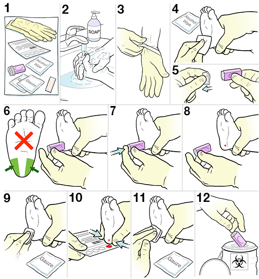 Step-by-Step: Heel Stick for an Infant