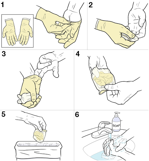 StepbyStep Sterile Technique for Taking Off Gloves Saint Luke's