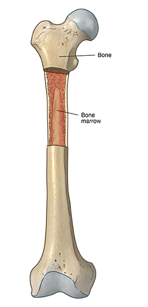 Bone Biopsy  Saint Luke's Health System