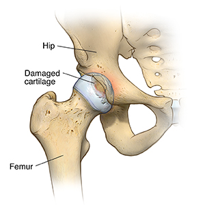 SkiL-Care Post-Hip Surgery Cushion