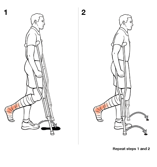 StepbyStep Using Crutches with Swing To (NonWeight Bearing) Saint