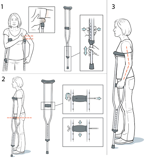 StepbyStep Fitting a Crutch Saint Luke's Health System