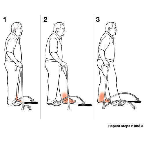 Step-by-Step: Using a Cane | Saint Luke's Health System