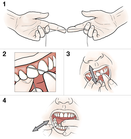 StepbyStep Flossing Your Teeth Saint Luke's Health System