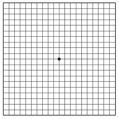 An Amsler grid is a test card that looks a lot like graph paper