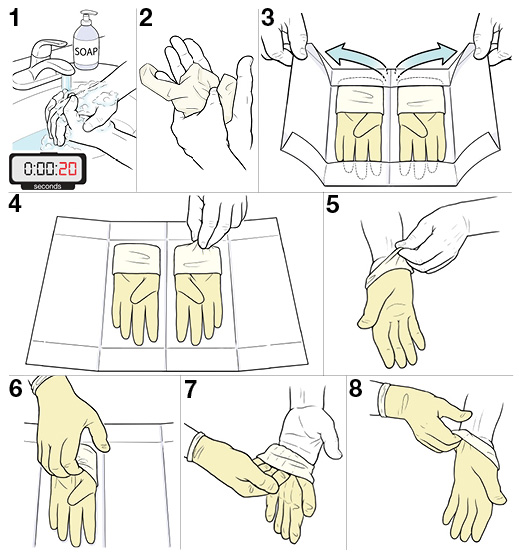 Step by Step Sterile Technique for Putting on Gloves Saint