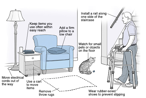 Which Side to Face Bed, Chair and Place Objects After Stroke for