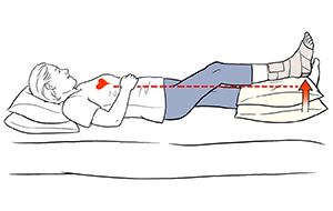 Understanding Ankle Sprain  Saint Luke's Health System