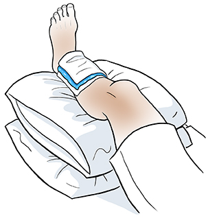 Shin Splints | Saint Luke's Health System