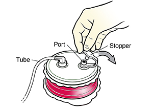 Surgical Drain Care: Care Instructions