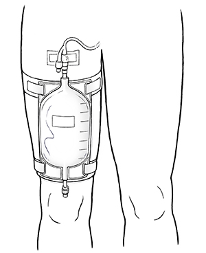 DCT Straps for urinary leg bag