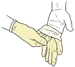 Gloved hand pulling sterile glove onto fingers of opposite hand.