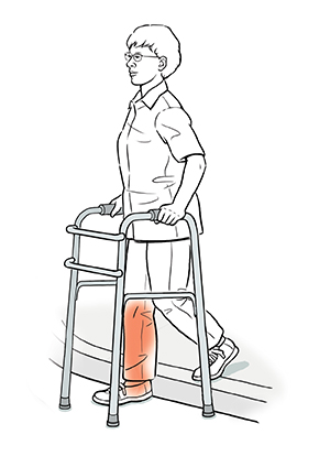 Discharge Instructions: Using a Walker to Go Up and Down Curbs | Saint ...