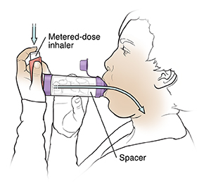 Woman using metered-dose inhaler with spacer.