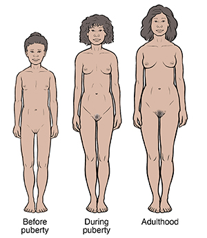 Puberty Age For Girls - Signs Of Puberty In Girls