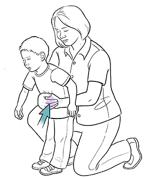 HEIMLICH MANEUVER PEDIATRIC TRAINING