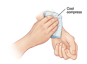 Hand placing ice pack on inner forearm of opposite arm.