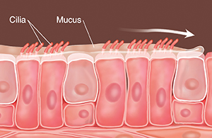 COPD: Coping with Mucus  Saint Luke's Health System