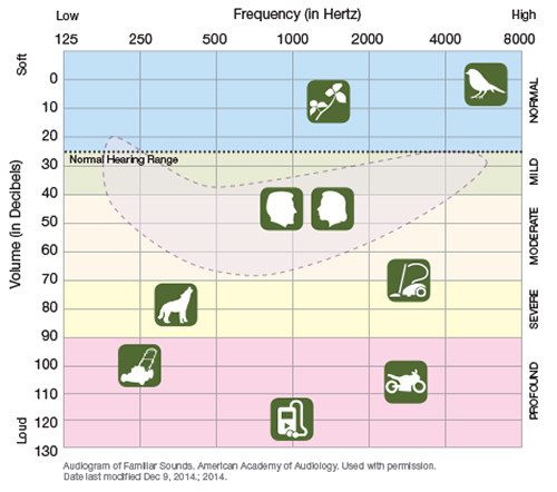 What Is an Audiogram? | Saint Luke's Health System