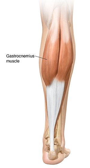 leg muscle strain