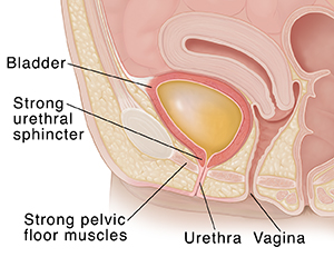 What Is Stress Urinary Incontinence Sui Saint Luke S Health