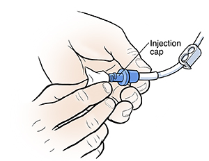 Discharge Instructions Flushing Your Central Venous Catheter Saint Luke S Health System