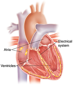 Understanding First Degree Heart Block Saint Luke S Health System