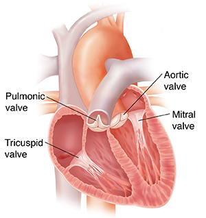 Heart murmur in baby