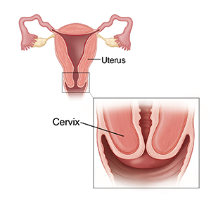 Cross section of uterus with inset showing closeup of cervix.