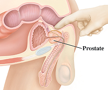 Finger prostata How to