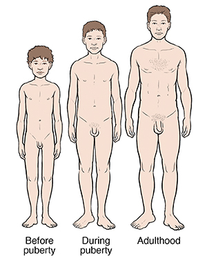 Puberty: Normal Growth and Development in Boys