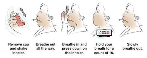 discharge-instructions-using-a-metered-dose-inhaler-saint-luke-s