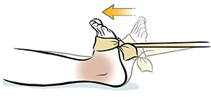 Ankle Dorsiflexion Strength Saint Luke s Health System