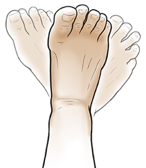 Strengthen feet and online ankles