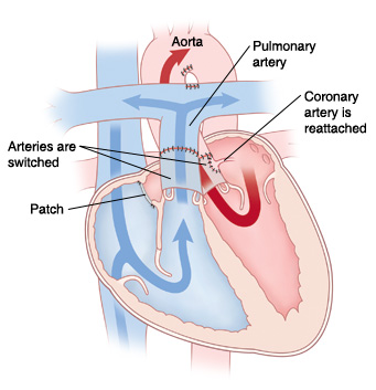 Aorta Artery