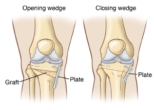 when the knee is extended the ankle cannot be passively