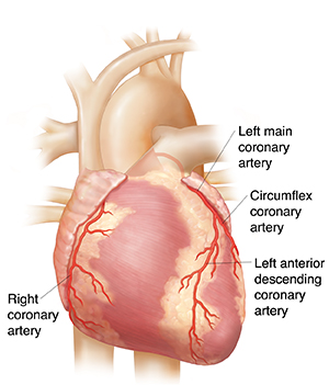 View Coronary Arteries Gallery