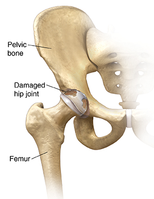 The Importance of Your Hip Joint