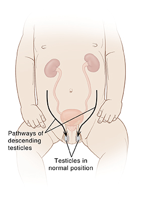 What is an Undescended Testicle Saint Luke s Health System