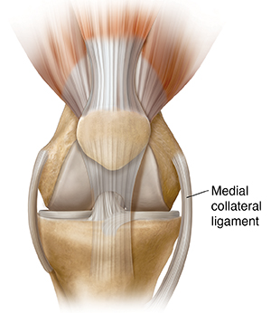 Understanding Medial Collateral Ligament Sprain | Saint Luke's Health System