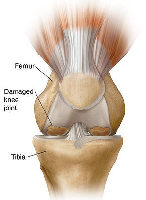 The knee clearance place