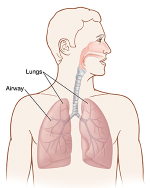 What Is Acute Bronchitis? | Saint Luke's Health System