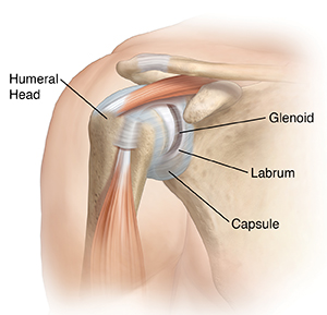 Bankart Lesion Of The Shoulder Joint Saint Luke S Health System