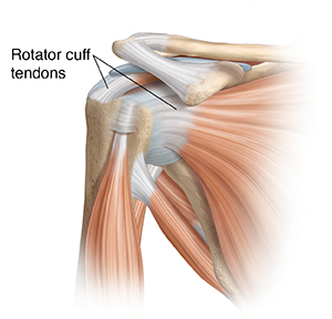 Rotator Cuff Injury  Saint Luke's Health System