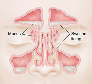 cilia in nose