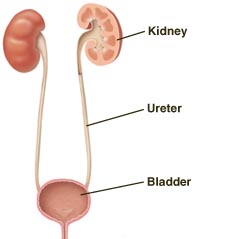 Cystography (Retrograde) | Saint Luke's Health System