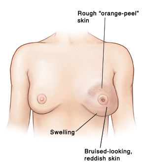 Inside of the Breast