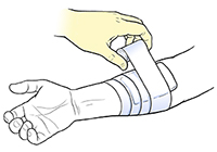 A guide on how to bandage injuries - Edmonton First Aid