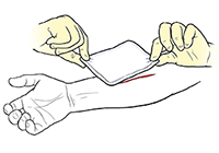 Types of bandaging in deals first aid